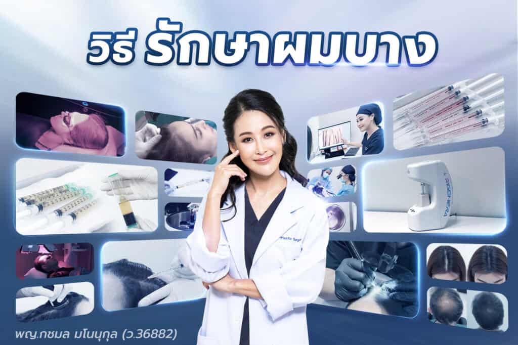 วิธีรักษาผมบาง