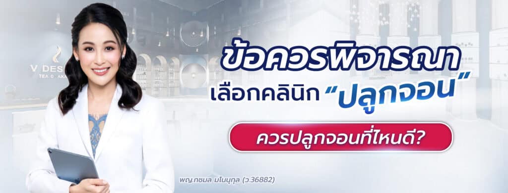 ปลูกจอนที่ไหนดี