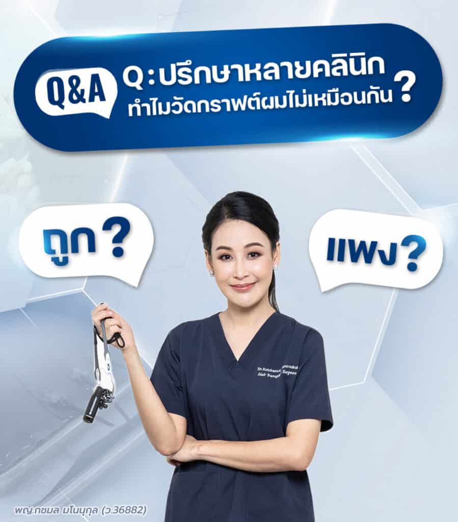 ราคาปลูกผม
