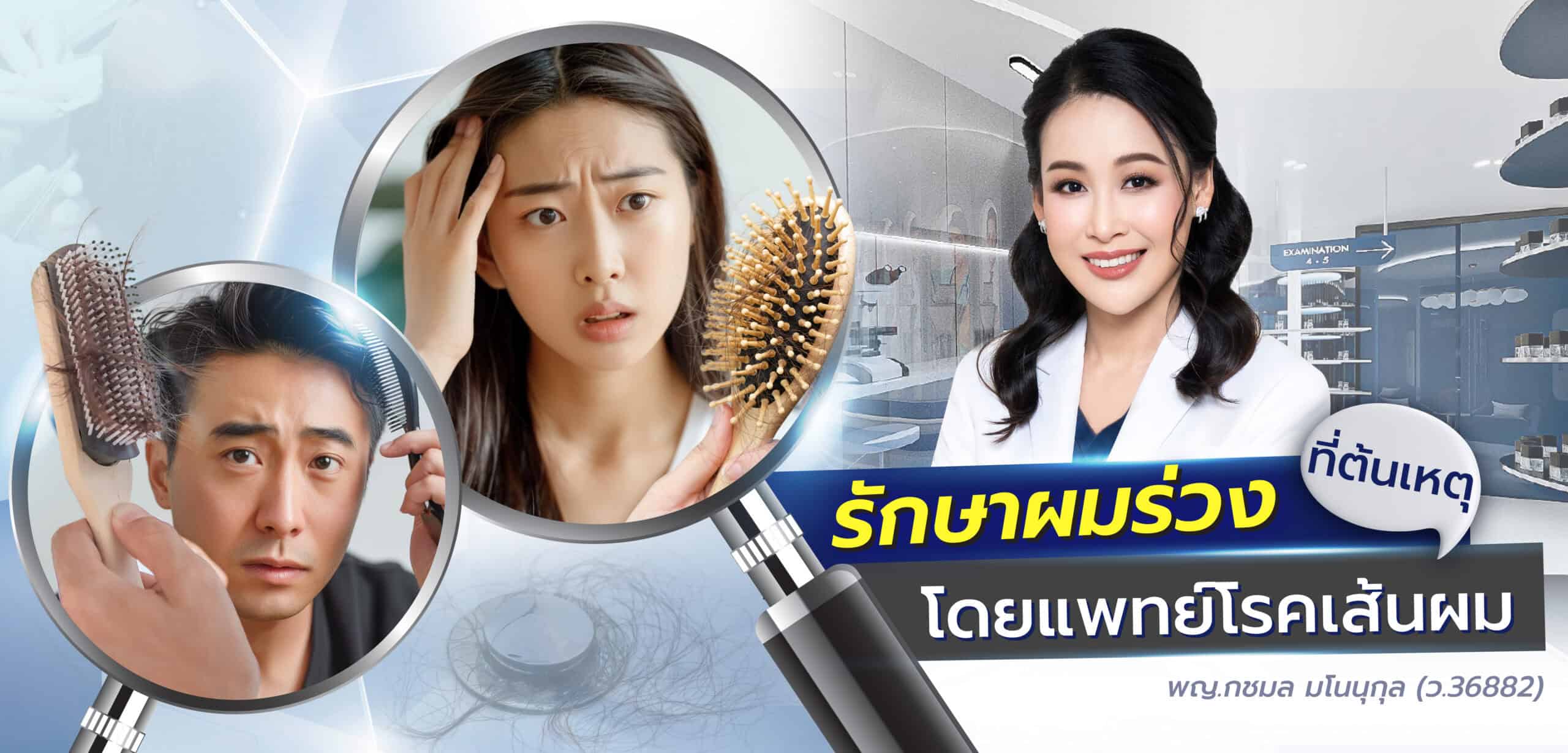 รักษาผมร่วง