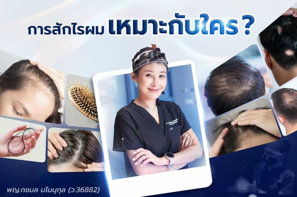 สักไรผมเหมาะกับใคร